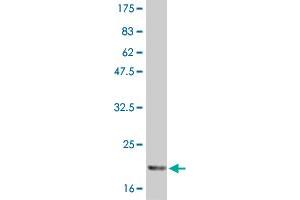Western Blot detection against Immunogen (21 KDa) .