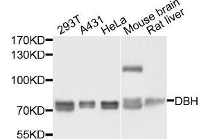 Western blot analysis of extracts of various cells, using DBH antibody. (DBH Antikörper)