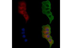 ABIN6258671 and ABIN6275143 staining Hela cells by IF/ICC. (TUBGCP4 Antikörper  (Internal Region))