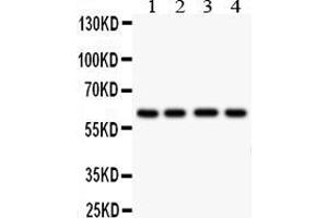 Anti- HEXA antibody, Western blottingAll lanes: Anti HEXA  at 0. (Hexosaminidase A Antikörper  (C-Term))