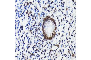 Immunohistochemistry of paraffin-embedded human appendix using K/TRIM28 antibody (ABIN7270986) at dilution of 1:100 (40x lens). (KAP1 Antikörper)