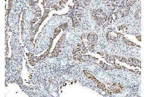 IHC analysis of DPY19L1 using anti-DPY19L1 antibody (ABIN7601445).