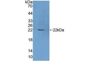 Detection of Recombinant PLCb1, Human using Polyclonal Antibody to Phospholipase C Beta 1 (PLCB1) (Phospholipase C beta 1 Antikörper  (AA 316-476))