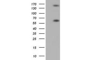 Western Blotting (WB) image for anti-Butyrophilin, Subfamily 1, Member A1 (BTN1A1) antibody (ABIN1496988) (BTN1A1 Antikörper)