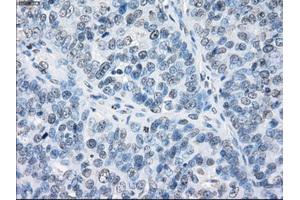 Immunohistochemical staining of paraffin-embedded Kidney tissue using anti-FCGR2A mouse monoclonal antibody. (FCGR2A Antikörper)