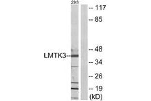Western blot analysis of extracts from 293 cells, using LMTK3 Antibody. (LMTK3 Antikörper  (AA 1251-1300))