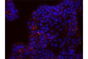 Immunofluorescence (IF) image for anti-CD24 Molecule (CD24) antibody (Alexa Fluor 647) (ABIN2657702) (CD24 Antikörper  (Alexa Fluor 647))