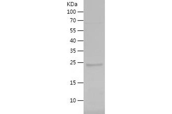 GANP Protein (AA 1771-1980) (His tag)