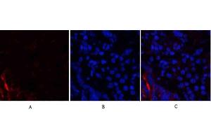 Immunofluorescence analysis of rat lung tissue. (PI3K p85 alpha/gamma Antikörper)