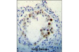 CDKN2B Antibody immunohistochemistry analysis in formalin fixed and paraffin embedded human lung tissue followed by peroxidase conjugation of the secondary antibody and DAB staining. (CDKN2B Antikörper  (C-Term))