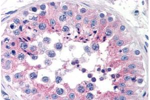 Human Testis (formalin-fixed, paraffin-embedded) stained with CLU antibody ABIN239817 at 10 ug/ml followed by biotinylated anti-mouse IgG secondary antibody ABIN481714, alkaline phosphatase-streptavidin and chromogen. (Clusterin Antikörper)