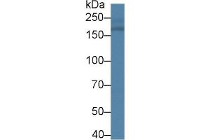 Western Blotting (WB) image for anti-Integrin alpha M (ITGAM) (AA 31-160) antibody (ABIN7433930)