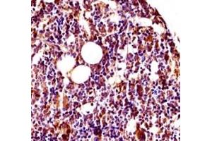 Immunohistochemistry (IHC) image for anti-V-Yes-1 Yamaguchi Sarcoma Viral Related Oncogene Homolog (LYN) (AA 1-30) antibody (ABIN3029563)