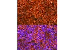 Immunofluorescence analysis of rat spleen using CD3D Rabbit mAb (ABIN7266193) at dilution of 1:100 (40x lens). (CD3D Antikörper)