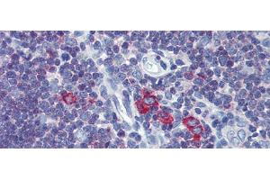 Immunohistochemistry with Human Thymus lysate tissue at an antibody concentration of 5. (Transferrin Receptor 2 Antikörper  (Middle Region))