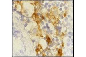 Immunohistochemistry (IHC) image for anti-CD209 (CD209) (Extracellular Domain) antibody (ABIN492511) (DC-SIGN/CD209 Antikörper  (Extracellular Domain))