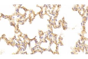 Detection of ICAM1 in Mouse Lung Tissue using Polyclonal Antibody to Intercellular Adhesion Molecule 1 (ICAM1) (ICAM1 Antikörper  (AA 328-465))
