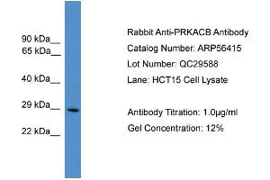 WB Suggested Anti-PRKACB  Antibody Titration: 0. (PRKACB Antikörper  (N-Term))