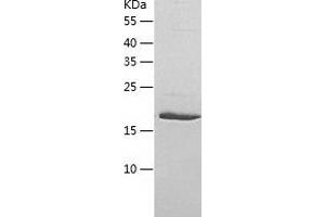 ULBP1 Protein (AA 26-216) (His tag)