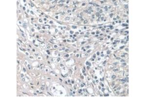 Detection of APOA1 in Human Prostate Gland Tissue using Monoclonal Antibody to Apolipoprotein A1 (APOA1)
