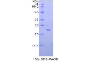 SDS-PAGE (SDS) image for Matrix Metallopeptidase 13 (Collagenase 3) (MMP13) (AA 70-245) protein (His tag) (ABIN2121613)
