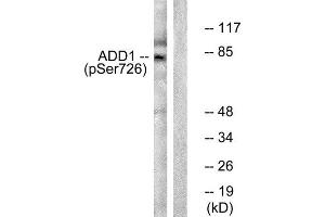 Western Blotting (WB) image for anti-Adducin 1 (Alpha) (ADD1) (pSer726) antibody (ABIN1847203) (alpha Adducin Antikörper  (pSer726))