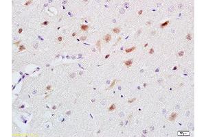 Formalin-fixed and paraffin embedded rat brain labeled with Anti-5-HT Polyclonal Antibody, Unconjugated  at 1:200 followed by conjugation to the secondary antibody and DAB staining. (Serotonin Antikörper)