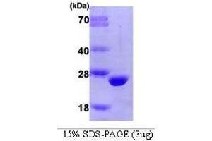Figure annotation denotes ug of protein loaded and % gel used. (Catechol-O-Methyltransferase (COMT) (AA 51-271) Peptid)