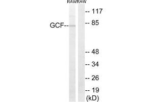 Western Blotting (WB) image for anti-GC-Rich Sequence DNA-Binding Factor 2 (GCFC2) (Internal Region) antibody (ABIN1851368) (GCFC2 Antikörper  (Internal Region))