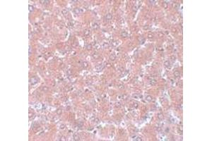 Immunohistochemistry (IHC) image for anti-Nsa1p (NSA1) (C-Term) antibody (ABIN1030550) (Nsa1p (NSA1) (C-Term) Antikörper)