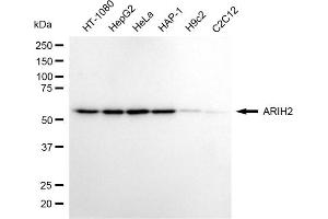 Western blotting analysis using ARIH2 antibody (ABIN7799974).