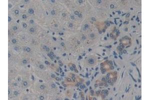 Immunohistochemistry (IHC) image for anti-Caspase Recruitment Domain Family, Member 9 (CARD9) (AA 26-283) antibody (ABIN7443479)