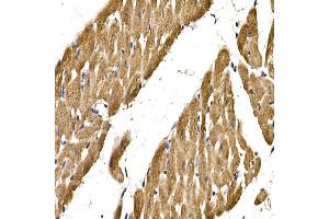 Immunohistochemistry of paraffin-embedded rat heart using PDGFB Rabbit pAb (ABIN3021688, ABIN3021689, ABIN3021690 and ABIN6215511) at dilution of 1:150 (40x lens). (PDGFB Antikörper  (AA 20-241))