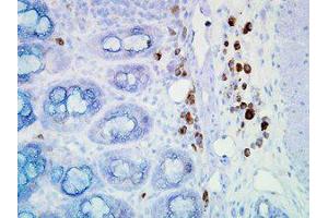 Hsp90 Immunohistochemistry.