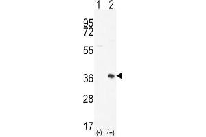 Western Blotting (WB) image for anti-Proto-Oncogene Pim-2 (Serine Threonine Kinase) (PIM2) antibody (ABIN3003584) (PIM2 Antikörper)