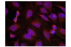 Image no. 1 for anti-B-Cell CLL/lymphoma 2 (BCL2) (Ser70) antibody (ABIN197204) (Bcl-2 Antikörper  (Ser70))