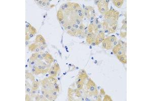 Immunohistochemistry of paraffin-embedded human stomach using CLIP1 antibody. (CLIP1 Antikörper  (AA 1228-1427))