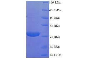 SDS-PAGE (SDS) image for Retinoschisin 1 (RS1) (AA 24-224) protein (His tag) (ABIN4974309)