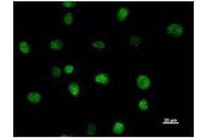 Immunostaining analysis in HeLa cells. (SATB2 Antikörper)