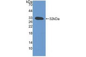 Western blot analysis of recombinant Mouse LTb. (LTB Antikörper  (AA 58-304))