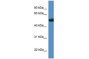WB Suggested Anti-Tigd4 Antibody Titration: 1. (TIGD4 Antikörper  (N-Term))
