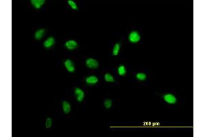 Immunofluorescence of monoclonal antibody to NPM1 on HeLa cell. (NPM1 Antikörper  (AA 1-294))