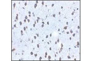 Immunohistochemistry of SCF in mouse brain tissue with this product at 2. (KIT Ligand Antikörper  (Center))