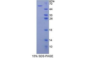 SDS-PAGE analysis of Human BAI3 Protein. (BAI3 Protein)