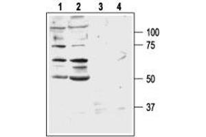 Western blot analysis of DU 145 (lanes 1 and 3) and PC-3 (lanes 2 and 4) human prostate carcinoma cell lines: - 1,2.