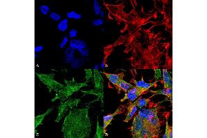 Immunocytochemistry/Immunofluorescence analysis using Mouse Anti-VAChT Monoclonal Antibody, Clone S6-38 . (SLC18A3 Antikörper  (AA 521-532) (FITC))