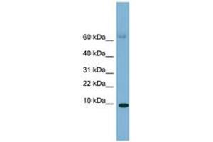 Image no. 1 for anti-Serum Amyloid A 4 (SAA4) (C-Term) antibody (ABIN6749724)