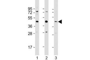 Western blot testing of 1) human HeLa, 2) human A549 and 3) mouse brain lysate with G6PC3 antibody at 1:1000. (G6PC3 Antikörper  (AA 215-246))