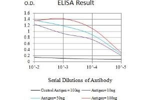 Black line: Control Antigen (100 ng),Purple line: Antigen (10 ng), Blue line: Antigen (50 ng), Red line:Antigen (100 ng) (S100B Antikörper  (AA 1-92))