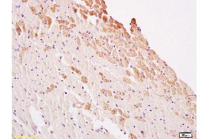 Formalin-fixed and paraffin embedded rat heart labeled with Anti LATS2 Polyclonal Antibody, Unconjugated (ABIN753553) at 1:200 followed by conjugation to the secondary antibody and DAB staining (LATS1,2 (AA 641-740) Antikörper)